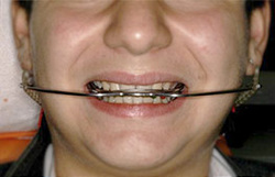 Meaningless Open phantom vizita la cabinet - Ortodontie, Stomatologie si Estetica DentaraCLINICA OMA  ORTODONTICA
